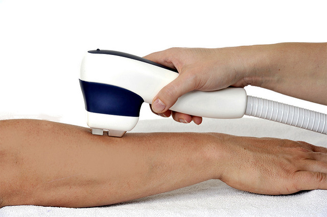 Trattamento epilazione laser